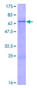 SDS-PAGE (GDF3-4825H).jpg